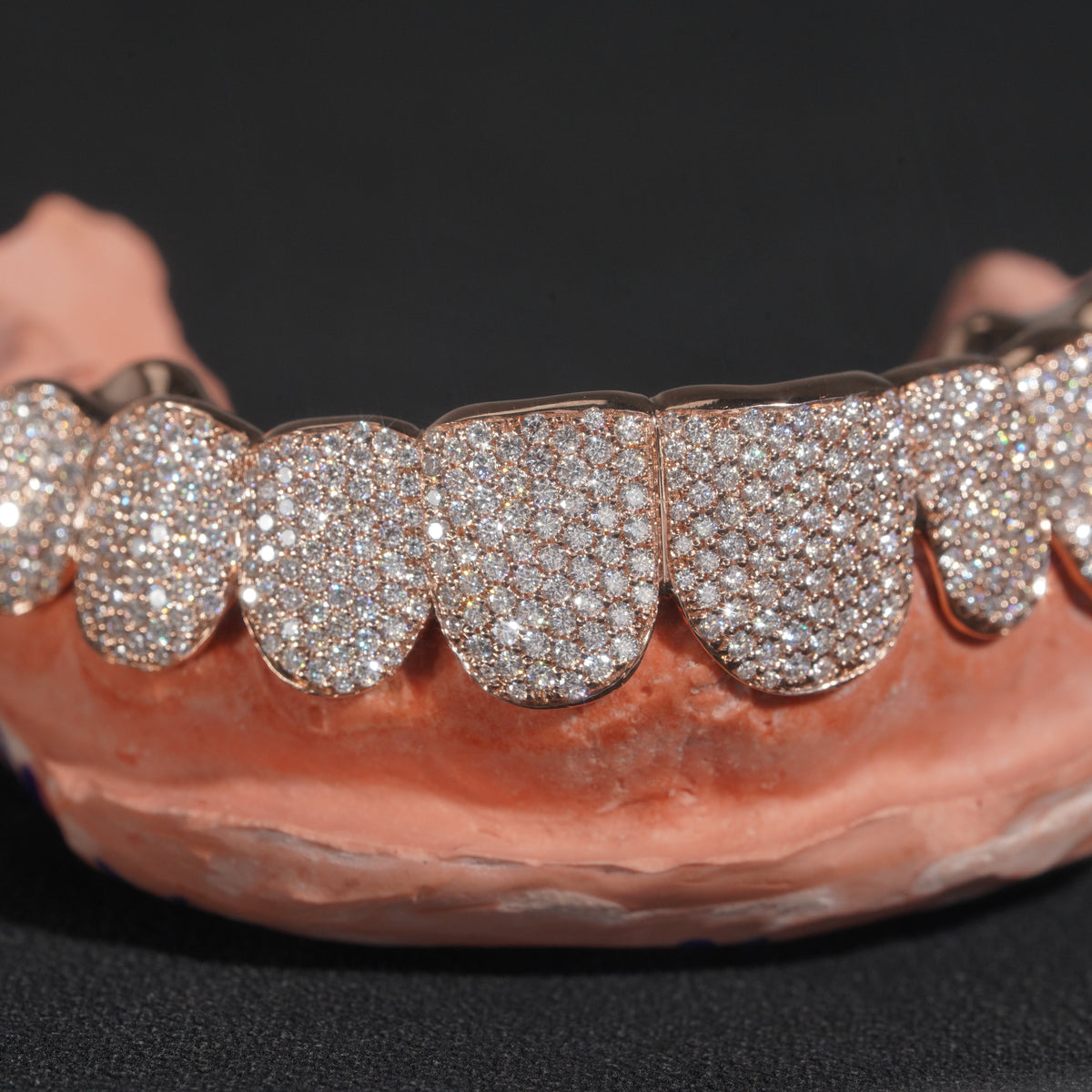 Custom Rose Pave Set Diamond Grillz