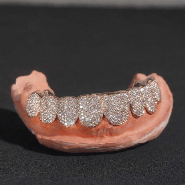 Custom Rose Pave Set Diamond Grillz